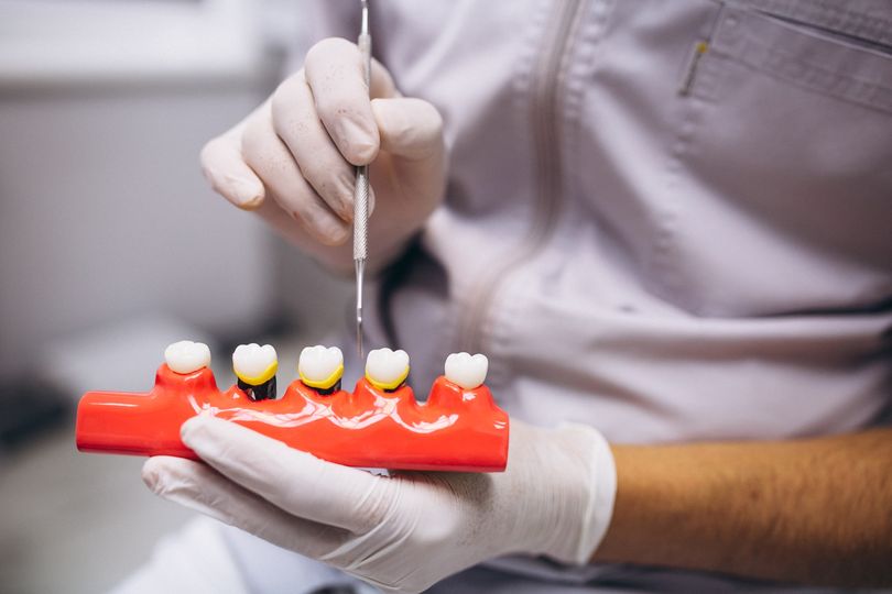  Prefeitura de Marilândia do Sul oferece implantes dentários para toda população