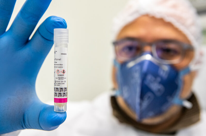  Em seis meses, Lacen processa 13.298 amostras de vírus respiratórios